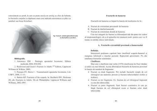 PARTEA I - TRAUMATOLOGIE FRACTURI ... - OvidiusMD