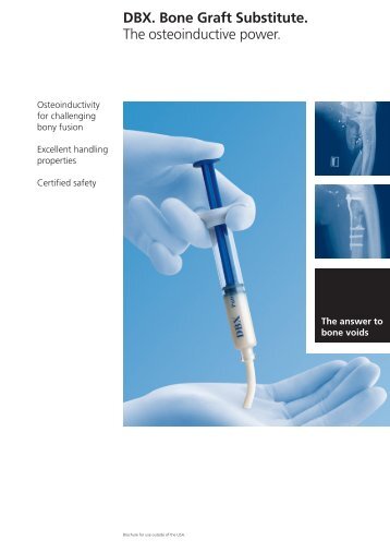 DBX. Bone Graft Substitute. The osteoinductive power. - Osteosyntese