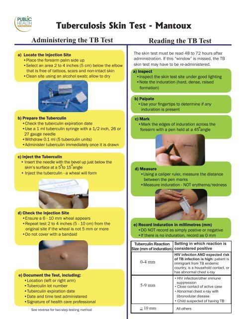 Tuberculosis: Testing and Reading TB Results - Grey Bruce Health ...