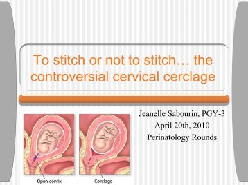 The Controversial Cervical Cerclage - Onehealth.ca