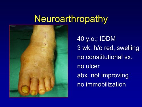 Evaluation and Treatment of Diabetic Neuroarthropathy - Medical ...