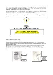 intervention pour syndrome de la jonction pyelo-ureterale - SociÃ©tÃ© ...