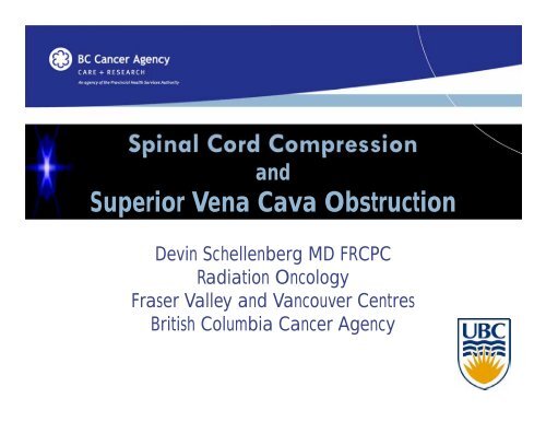 Spinal Cord Compression Superior Vena Cava Obstruction