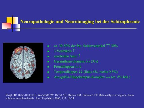 Schizophrenie - Medizinische UniversitÃ¤t Graz