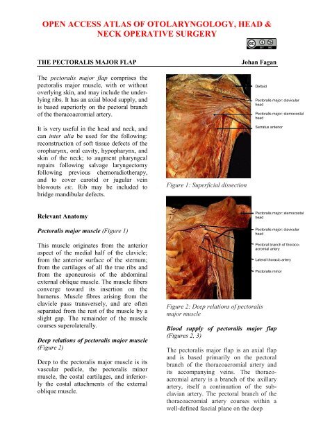 Pectoralis major flap - Vula - University of Cape Town