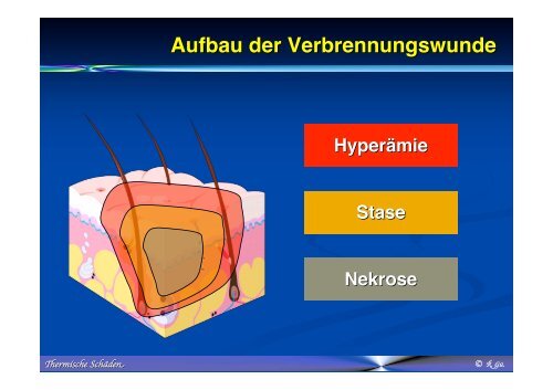 Thermische SchÃ¤den