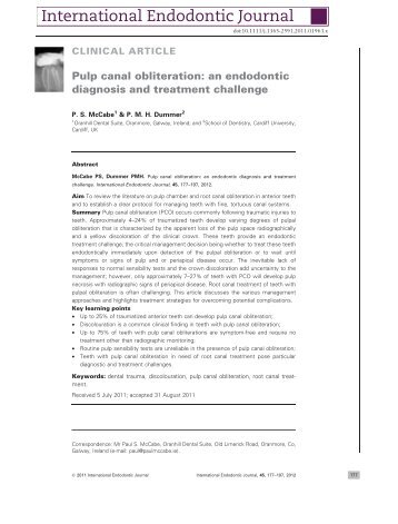 Pulp canal obliteration: an endodontic diagnosis and treatment ...