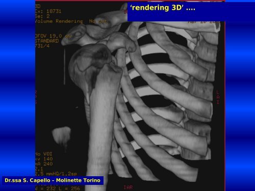 Dalla fisica nuovi strumenti per la diagnosi e la cura dei ... - I@PhT