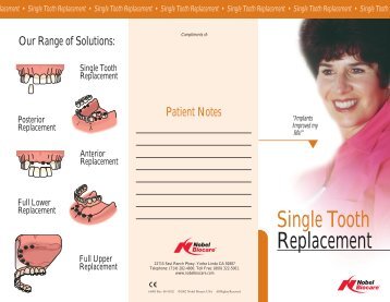 Single Tooth Replacement Brochure - Dental Implant