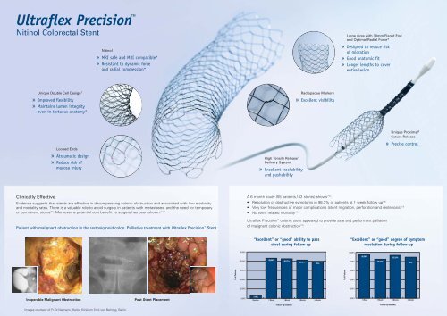 Ultraflex Precision