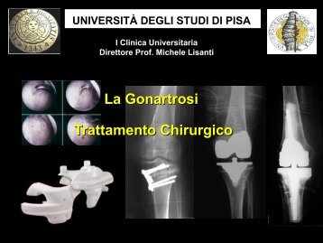 7. Tratt Chirurg Gonartrosi.pdf - Azienda USL 5 Pisa