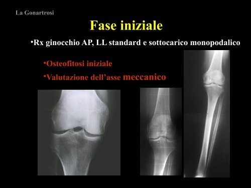 7. Tratt Chirurg Gonartrosi.pdf - Azienda USL 5 Pisa