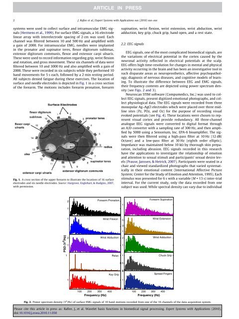 Wavelet basis functions in biomedical signal processing