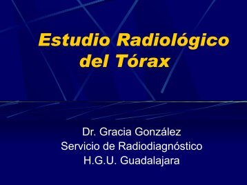 Estudio RadiolÃ³gico del TÃ³rax - VeoApuntes.com