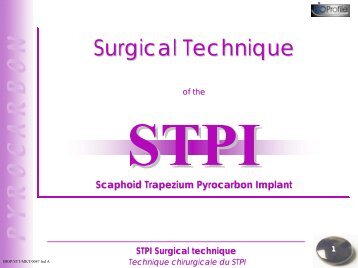 STPI Surgical technique Technique chirurgicale du STPI