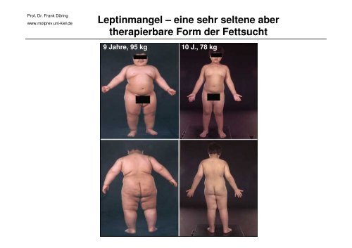 Die Bedeutung der Gene für Ernährung und Gesundheit