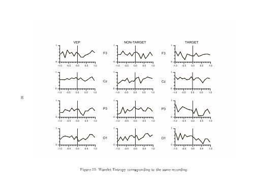 Quantitative analysis of EEG signals: Time-frequency methods and ...