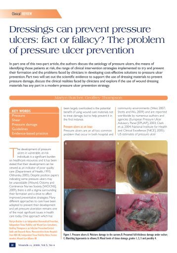 Dressings can prevent pressure ulcers: fact or fallacy? - Wounds ...