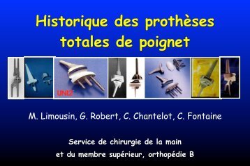 ProthÃ©ses poignet - ClubOrtho.fr