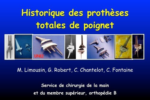ProthÃ©ses poignet - ClubOrtho.fr