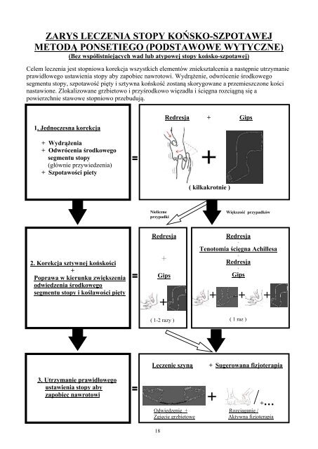 zarys leczenia stopy koÅsko-szpotawej metodÄ ... - Global HELP