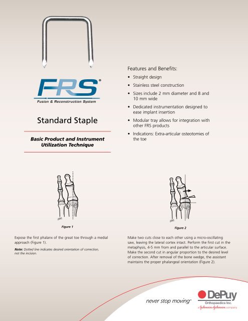 FRSÃ‚Â® Fusion and Reconstruction System Standard Staple ... - Biomet
