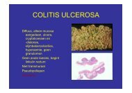 Collitis ulcerosa - Utrecht Digestive Center