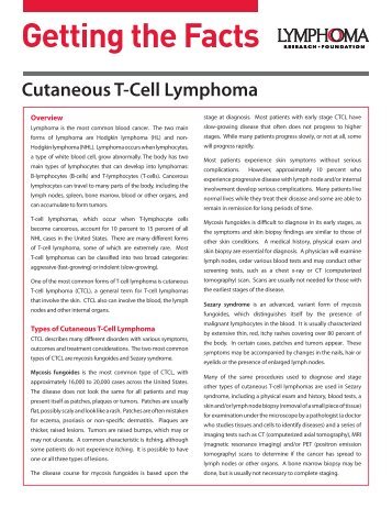 Cutaneous T-cell Lymphoma (CTCL) or Mycosis Fungoides