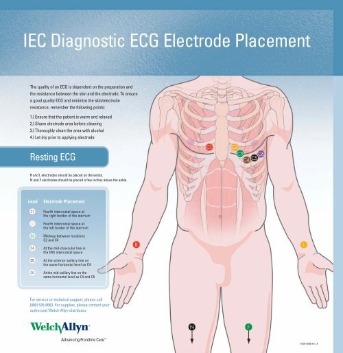 IEC Diagnostic ECG