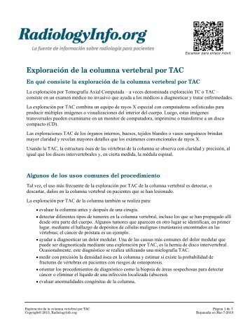 ExploraciÃ³n de la columna vertebral por TAC - RadiologyInfo