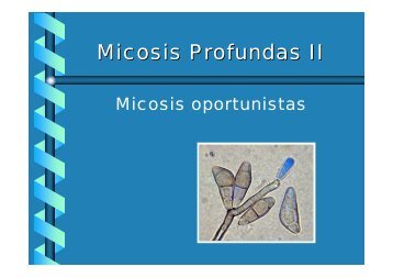 Micosis Profundas II
