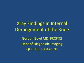 Xray Findings in Internal Derangement of the Knee