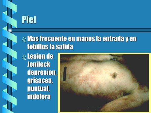 Lesiones por electricidad - Reeme.arizona.edu