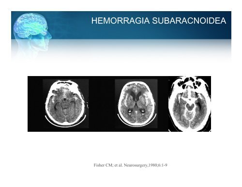 Manejo Inicial del Paciente con Enfermedad Vascular Cerebral