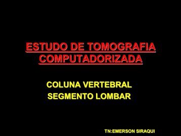 ESTUDO DE TOMOGRAFIA COMPUTADORIZADA - Comunidades