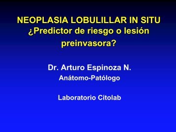 NEOPLASIA LOBULILLAR IN SITU Â¿Predictor de riesgo o lesiÃ³n ...