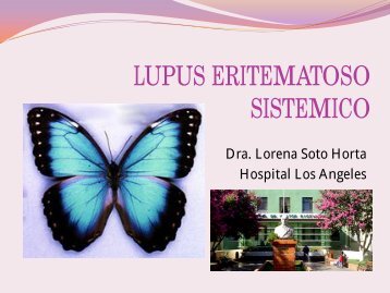 Lupus Eritematoso SistÃ©mico