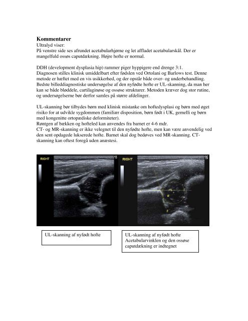 Sygehistorie Billeder Diagnose