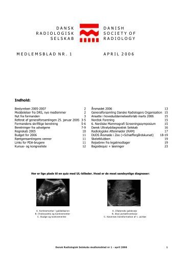 PDF-fil - Dansk Radiologisk Selskab