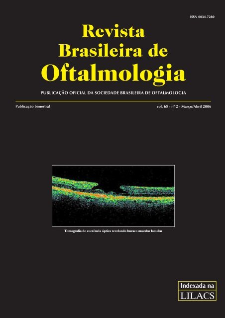 en síntomas compatibles de ram de diabetes