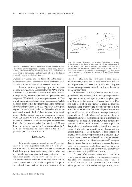 Mar-Abr - Sociedade Brasileira de Oftalmologia