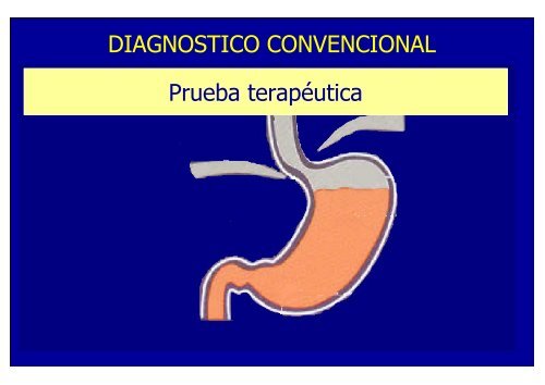 nuevos metodos de diagnostico en erge