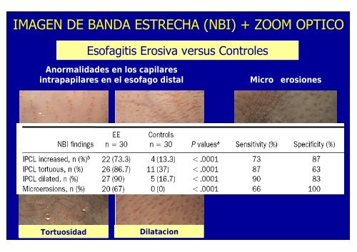 nuevos metodos de diagnostico en erge