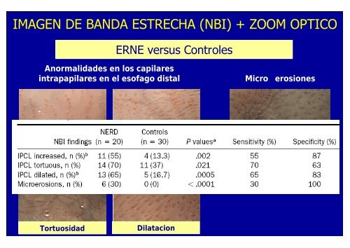 nuevos metodos de diagnostico en erge