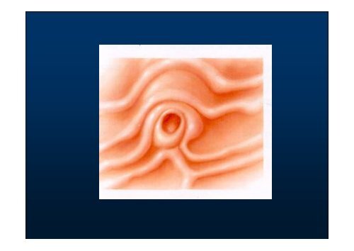 Indicaciones de la ERCP - ClÃ­nica de GastroenterologÃ­a. - Hospital ...