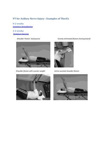 PT for Axillary Nerve Injury : Examples of TherEx