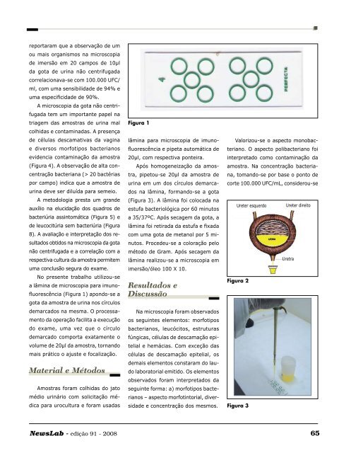 Emprego da LÃƒÂ¢mina de ImunofluorescÃƒÂªncia na ... - NewsLab