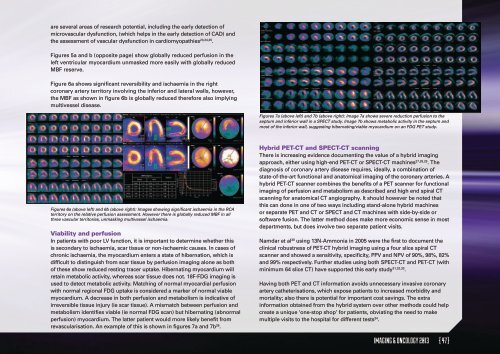 Imaging & Oncology - Society of Radiographers