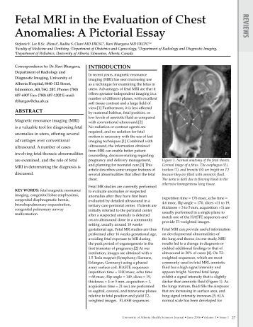 mri essays mri essays