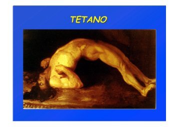 TETANO